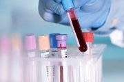بیماری‌ ها چه اثراتی بر آزمایش خون دارند؟
